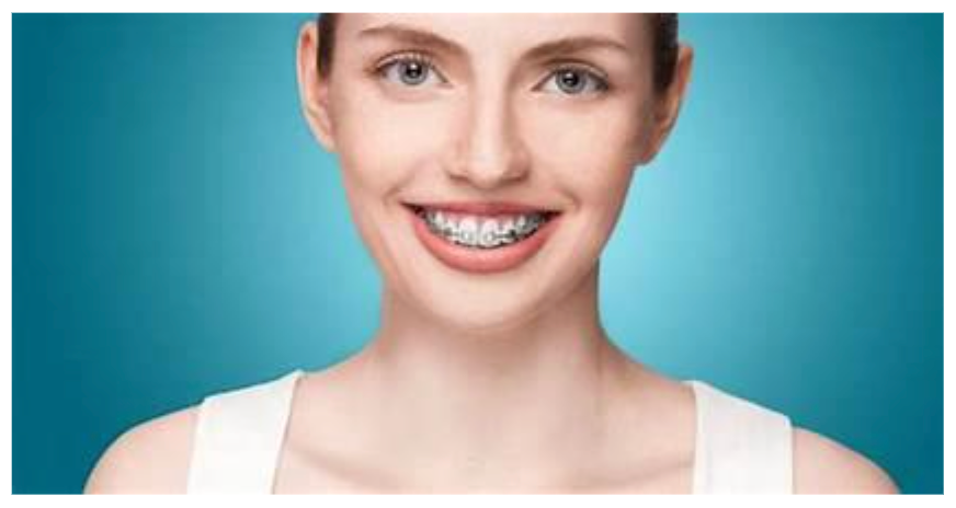 Root Canal Treatment